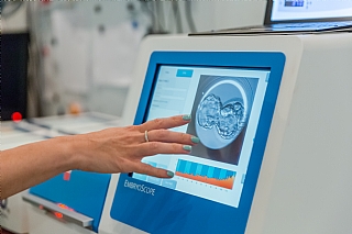 embryoscope
