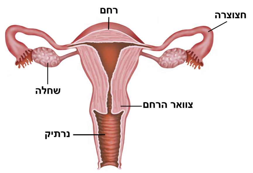 שינוי טרום סרטני בצוואר הרחם